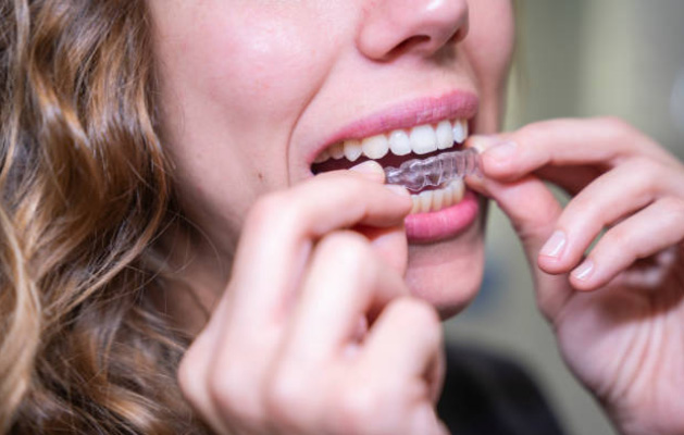 How long does Invisalign® take?