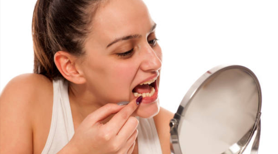 Are your gums Receding?